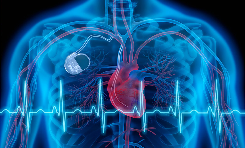 Can a Cardiac Pacemaker Help Find a Missing Person?